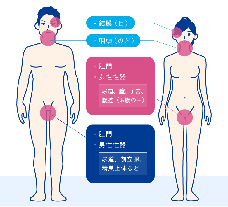 咽頭癌（中・下咽頭癌）｜電子コンテンツ|日本医事新報社