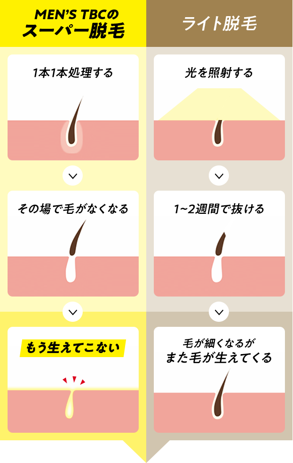 満足度９８.８%「TBCスーパー脱毛」はここまでスゴかった！３２年間 １度も剃る抜くしていないワキ公開！両ワキ体験キャンペーン実施中！ | TBC