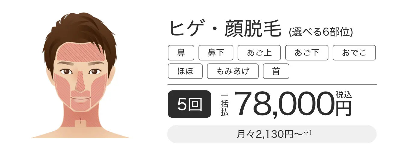 メンズ脱毛の値段の相場は？医療脱毛とエステサロンを徹底比較！安くする方法も解説