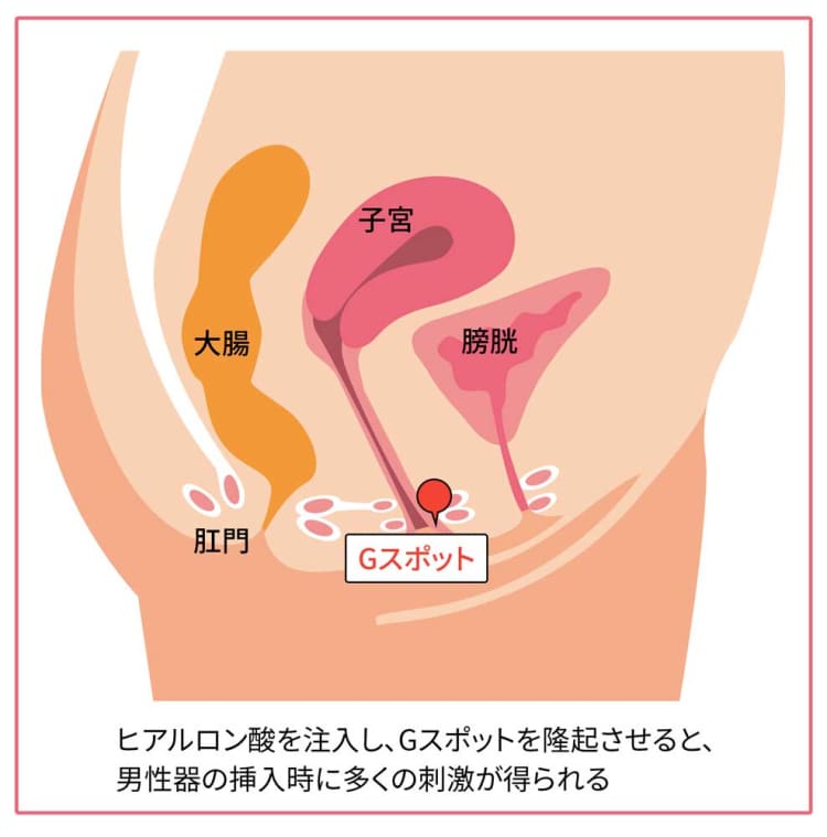 膣内カメラのおすすめは？安全に中がしっかり見えるカメラ付きバイブをまとめてみた￼ | Men's Chinchi