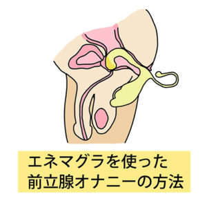 Enemagra(R)Dildo 彩【irodori】 (エネマグラ ディルド