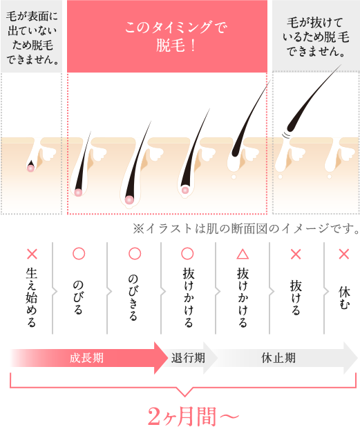 メンズTBCのヒゲ脱毛を徹底解説！スーパー脱毛の効果、料金、評判、口コミ、予約方法まとめ | お得に脱毛するなら「めいぶろ」