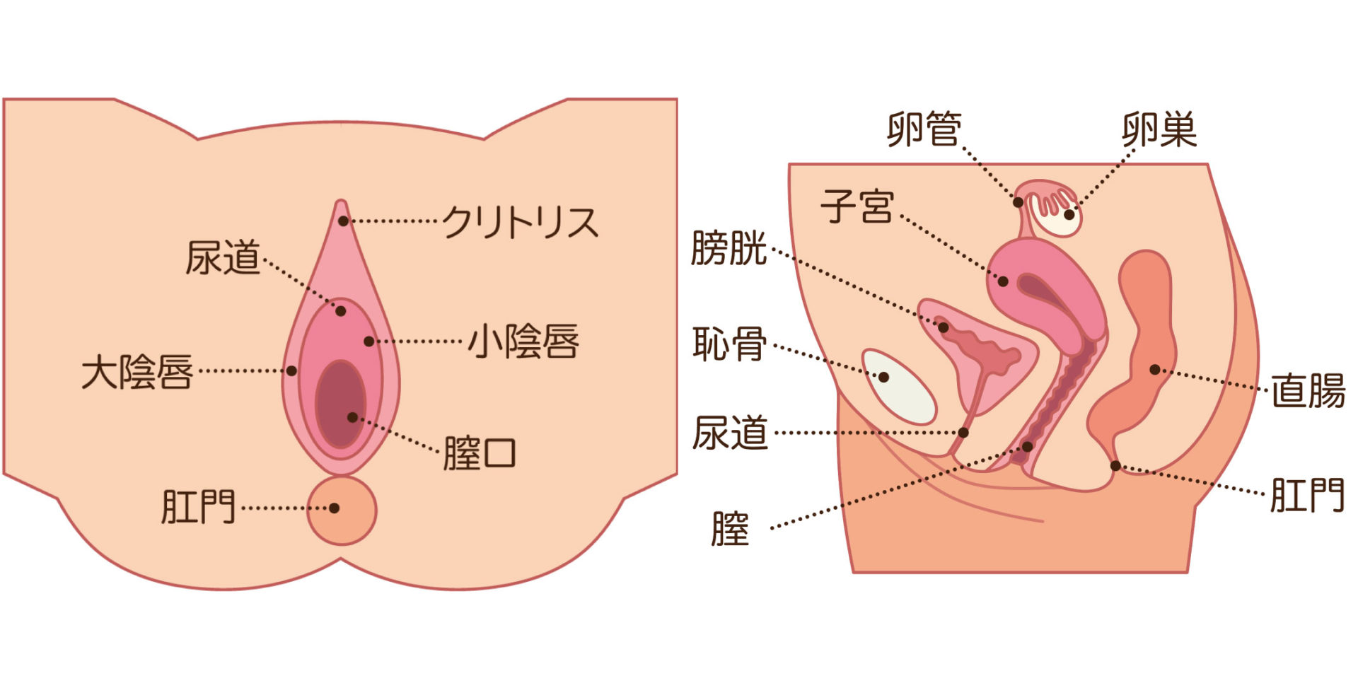 陰核包皮縮小術 ,婦人科脱色治療 ，真正陰核（クリトリス）包茎 ＜陰核（クリトリス）恥垢、恥石＞