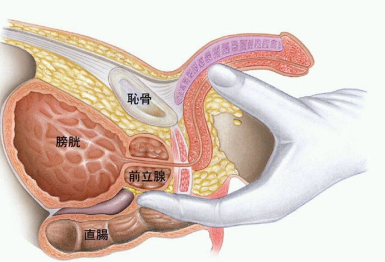 Gトリートメント（膣ヒアルロン酸注入） – Pillクリニック｜ピル処方・婦人科・美容形成総合クリニック