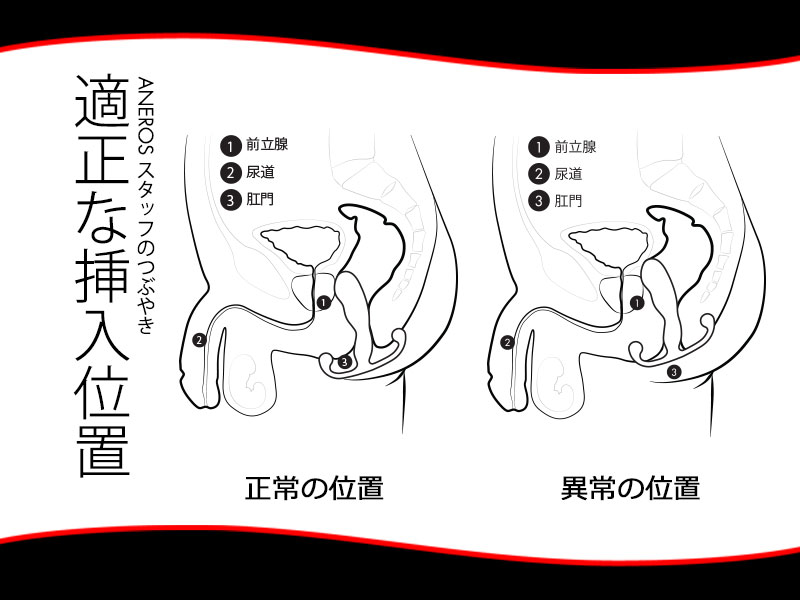 慢性前立腺炎（慢性前列腺炎） - 東大阪市で数少ない自律神経専門整体院