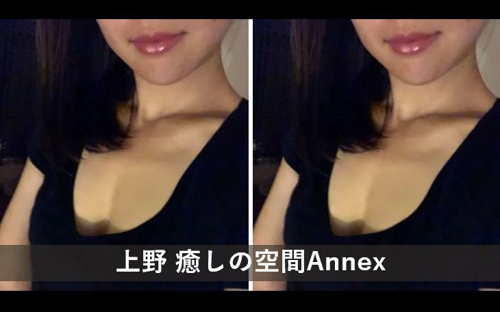 体験】上野 癒しの空間ANNEX(ゆきの)～そのままの君でいい～ | 不死鳥のメンズエステ｜メンズエステ体験談