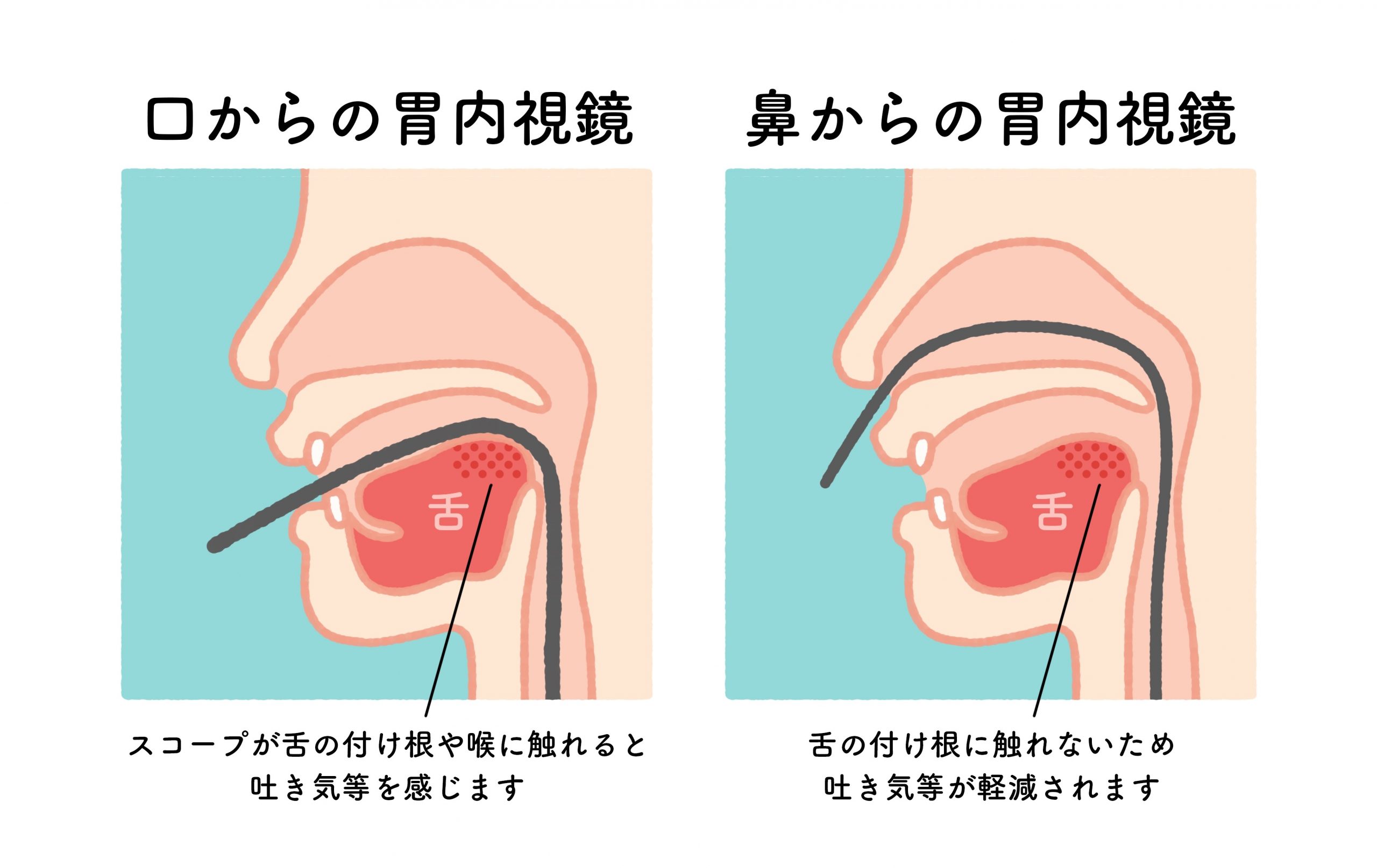 グリッド線のパスを編集する