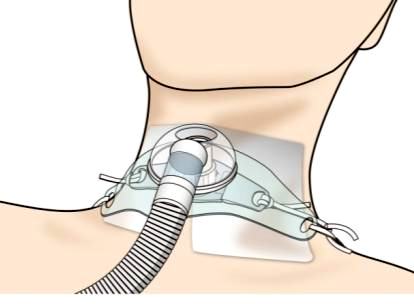 ノートパソコン Inspiron 14 2-in-1 アイスブルー MI764CP-ENLC14.0型Windows11 HomeAMDRyzen 5メモリ：8GBSSD：512GB日本語版キーボード2024年夏モデル の通販はソフマップ sofmap