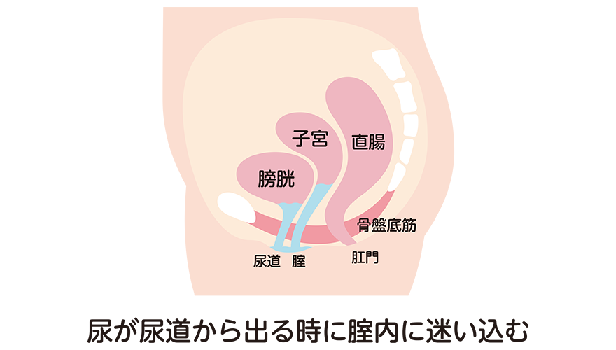 特集「気になるおりものの異常とかゆみ」｜山口レディスクリニック 神戸三宮の婦人科クリニック