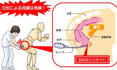 Amazon | Soxeeh 多目的洗浄器