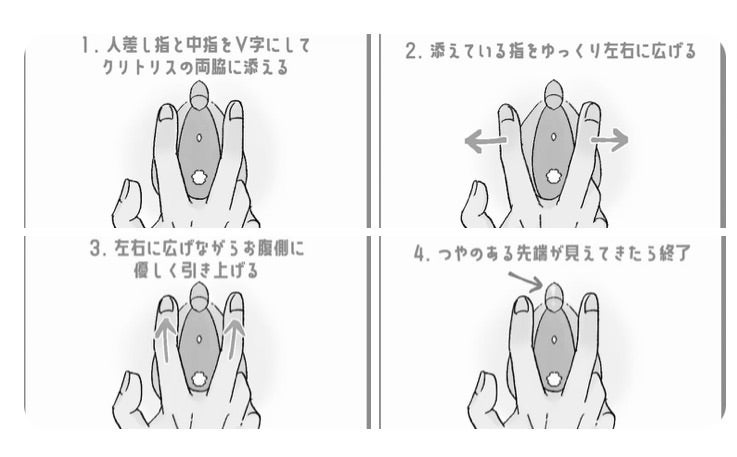 クリトリス包茎｜あんぬクリニック-女性器,女医,婦人科,美容外科,福岡