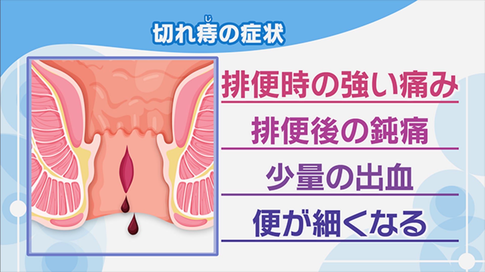 ちゃんと洗っているのに肛門が臭い！？原因と対策は…… | 横浜市新横浜近郊で痔の日帰り手術ならららぽーと横浜クリニック