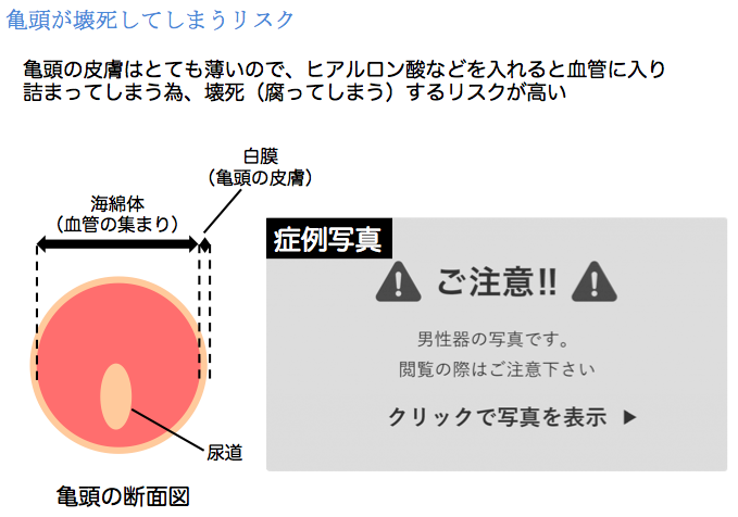 早漏対策｜池袋GOHクリニック