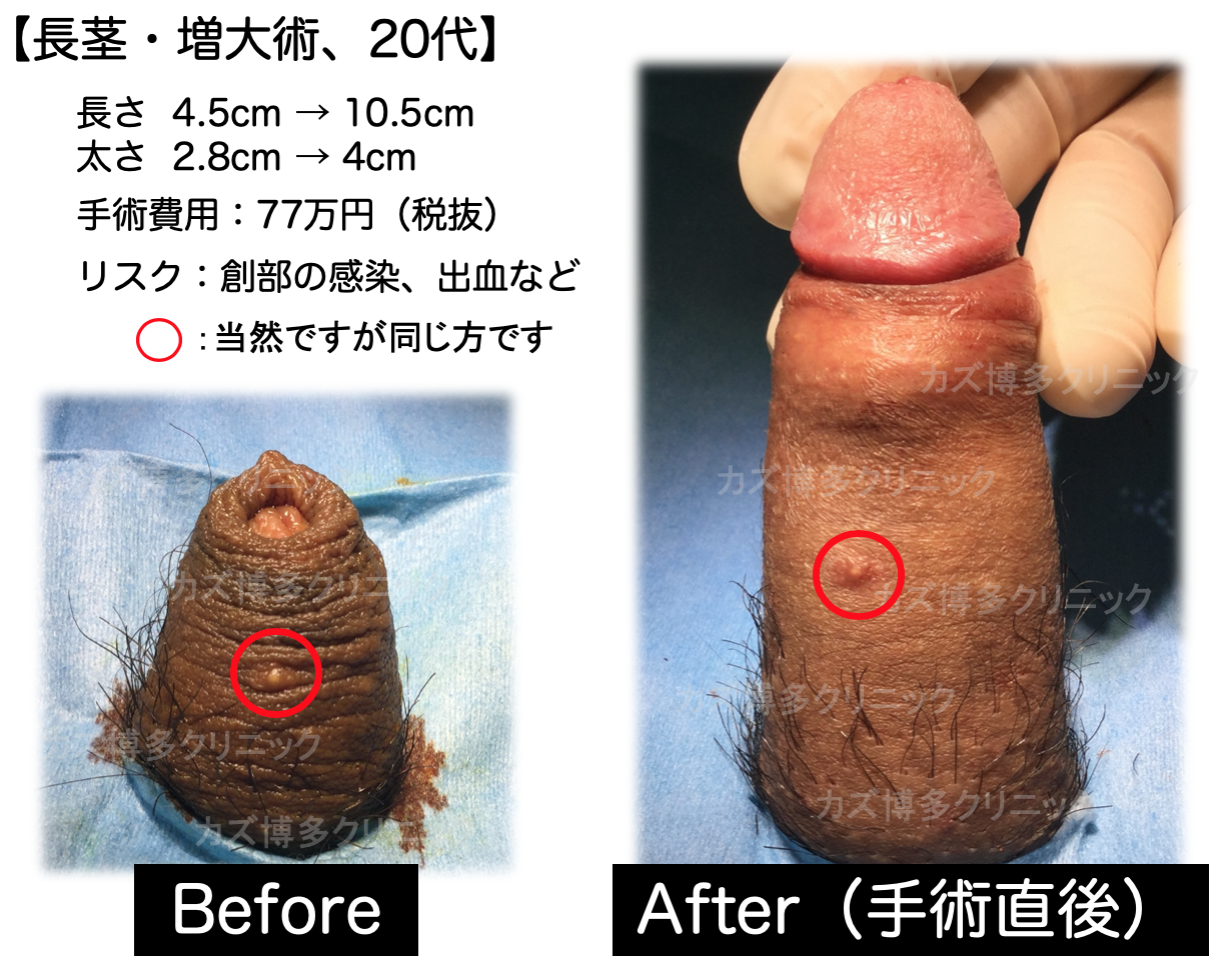 膣の長さの平均は？挿入などエッチとの関係性って？意外と知らない膣の構造をチェック【快感スタイル】