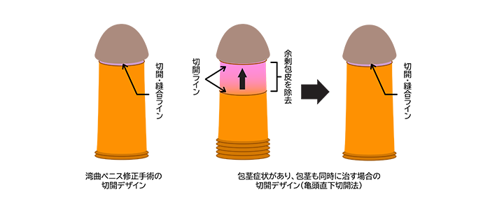 女性に好かれる上反りペニスとは？上向きペニスとの違いやトレーニング方法など | ザヘルプM