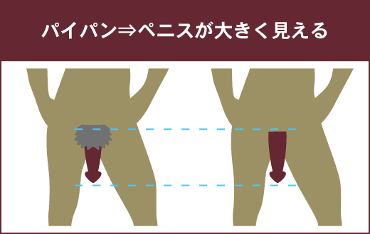 ハイジニーナ、パイパンとは？後悔とやり方 - 夜の保健室