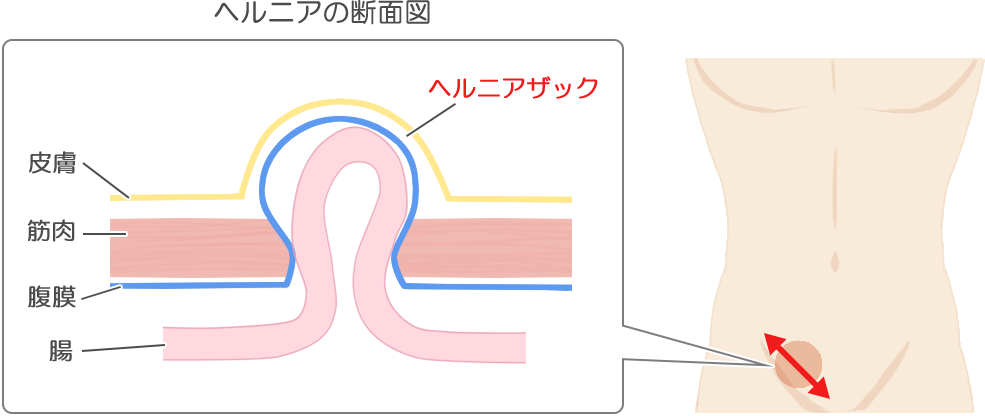 リハビリテーション｜佐賀市久保田町の整形外科・リハビリ｜のだ整形外科クリニック