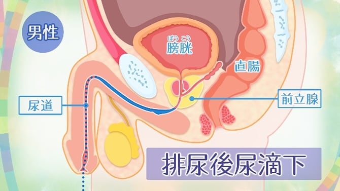 前立腺肥大症 - まりこ泌尿器・漢方内科（愛知県