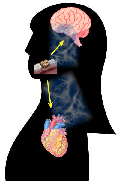 ガルバニック電流の影響大阪市住吉区あびこの歯医者「なかの歯科クリニック」