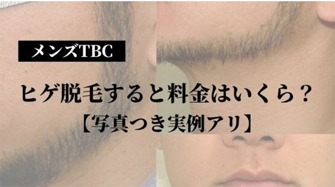 公式】MEN'S TBC梅田本店のお客様の声(1)｜MEN'S TBC