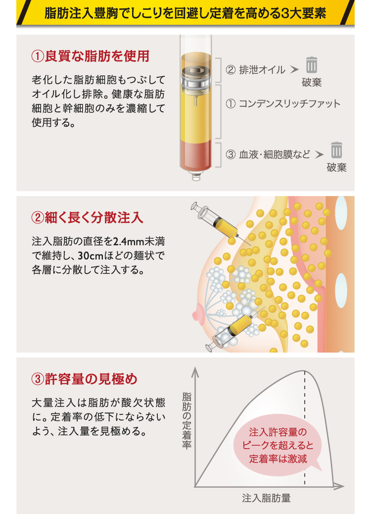 美容外科選びの相談所🏥 二重全切開•グラマラスライン•鼻整形•眼瞼下垂•人中短縮•プロテーゼ•豊胸•ハムラ法•脂肪吸引 |  マジで綺麗なオトガイしてる人ってここにハイライト当たるんよな。