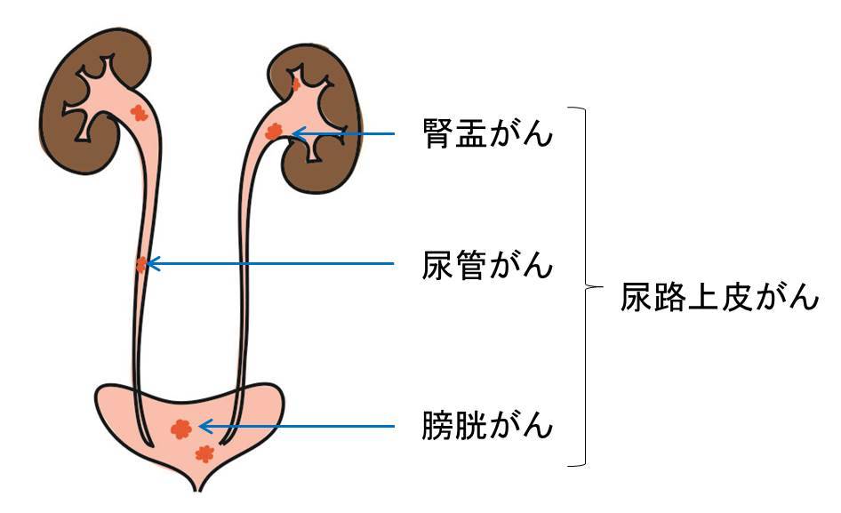 男なら避けられない！？ 迫り来る前立腺肥大症と前立腺がんの脅威：男を悩ませる「前立腺」問題：日経Gooday（グッデイ）