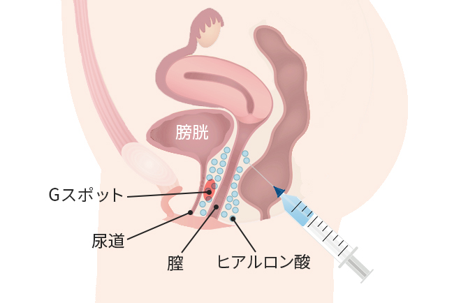 45歳で第3子出産の産後にセックスでイクためのGスポットの見つけ方【産婦人科医監修】 -  臨床心理士・パーソナルトレーナーの小中学生復学支援・小学生・中学生家庭教育支援・ 不登校母親メンタルサポート