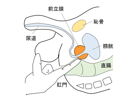 骨盤臓器脱手術 │ 婦人科