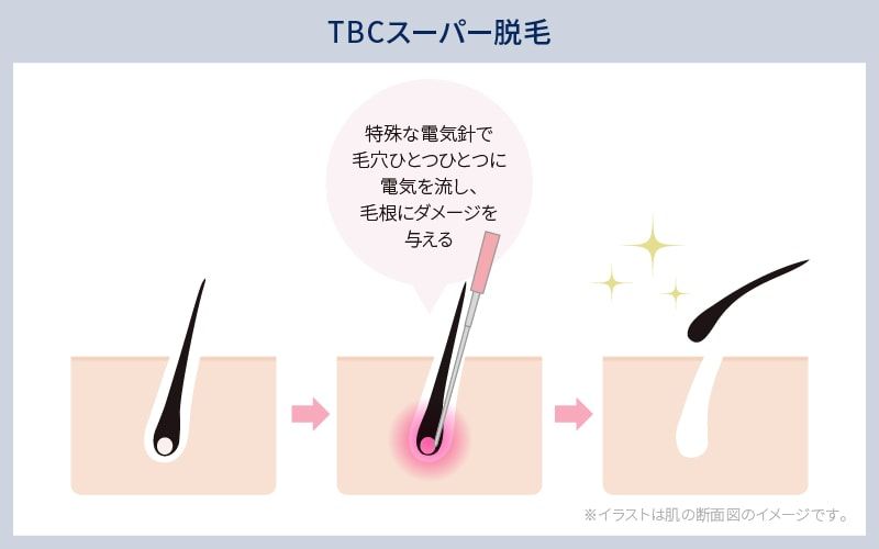 ティービーシー（TBC） エピワックスシート｜【ハンズネットストア】