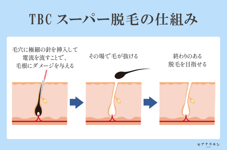 公式 TBC ヒカリビューティ 4 PRO