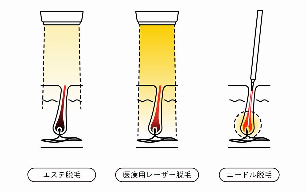 Amazon | TBC エステティックTBC